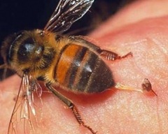 помощь при укусах насекомых